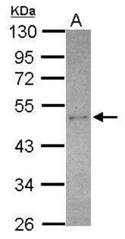 Invitrogen SEC14L2 Polyclonal Antibody 100 &mu;L; Unconjugated:Antibodies,