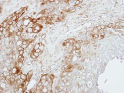 Invitrogen ZNF346 Polyclonal Antibody 100 &mu;L | Buy Online | Invitrogen&trade; | Fisher Scientific