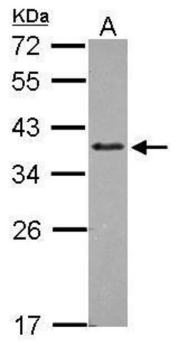 Invitrogen ZNF346 Polyclonal Antibody 100 &mu;L | Buy Online | Invitrogen&trade; | Fisher Scientific