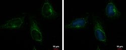 Invitrogen ACOT9 Polyclonal Antibody 100 &mu;L; Unconjugated:Antibodies,