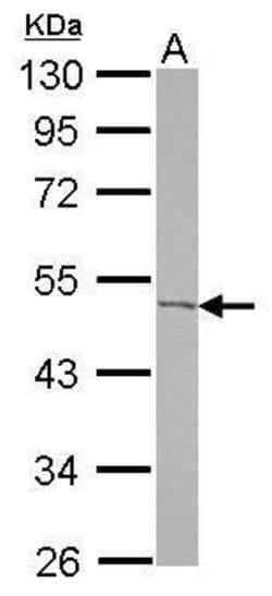 ACOT9 Polyclonal Antibody, Invitrogen&trade; 100 &mu;L; Unconjugated 