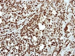 PATZ1 Polyclonal Antibody, Invitrogen 100 &mu;L; Unconjugated:Antibodies,