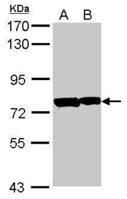 PATZ1 Polyclonal Antibody, Invitrogen 100 &mu;L; Unconjugated:Antibodies,