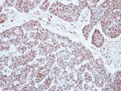 PATZ1 Polyclonal Antibody, Invitrogen 100 &mu;L; Unconjugated:Antibodies,