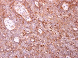 Invitrogen Coronin 3 Polyclonal Antibody 100 &mu;L; Unconjugated:Antibodies,