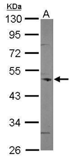 Invitrogen Coronin 3 Polyclonal Antibody 100 &mu;L; Unconjugated:Antibodies,