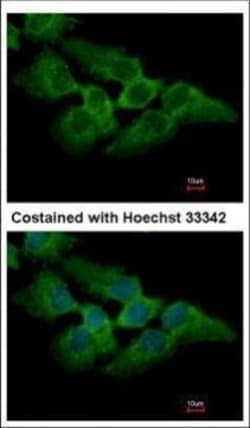 Invitrogen MKRN2 Polyclonal Antibody 100 &mu;L; Unconjugated:Antibodies,