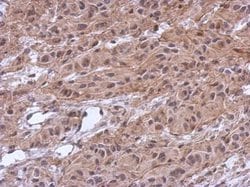 Invitrogen MKRN2 Polyclonal Antibody 100 &mu;L; Unconjugated:Antibodies,