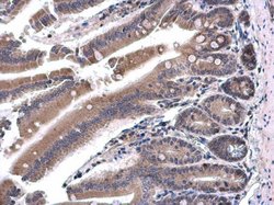 Invitrogen SH3BP1 Polyclonal Antibody 100 &mu;L; Unconjugated:Antibodies,