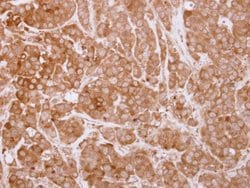Invitrogen SH3BP1 Polyclonal Antibody 100 &mu;L; Unconjugated:Antibodies,
