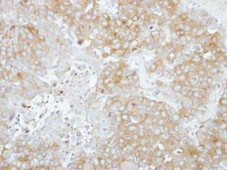 Invitrogen RABGAP1 Polyclonal Antibody 100 &mu;L; Unconjugated:Antibodies,