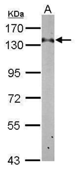 Invitrogen RABGAP1 Polyclonal Antibody 100 &mu;L; Unconjugated:Antibodies,