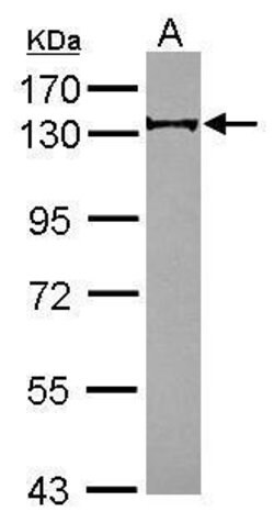 Invitrogen RABGAP1 Polyclonal Antibody 100 &mu;L; Unconjugated:Antibodies,