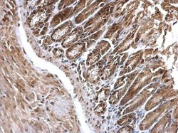 Invitrogen EDC4 Polyclonal Antibody 100 &mu;L; Unconjugated:Antibodies,