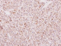 Invitrogen EDC4 Polyclonal Antibody 100 &mu;L; Unconjugated:Antibodies,