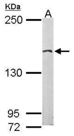 Invitrogen EDC4 Polyclonal Antibody 100 &mu;L; Unconjugated:Antibodies,