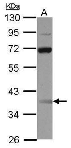 Invitrogen SSBP3 Polyclonal Antibody 100 μL; Unconjugated:Antibodies,