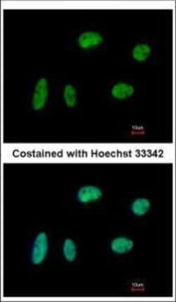 Invitrogen KIF4A Polyclonal Antibody 100 &mu;L; Unconjugated:Antibodies,