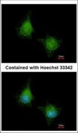 Invitrogen EML2 Polyclonal Antibody 100 &mu;L; Unconjugated:Antibodies,