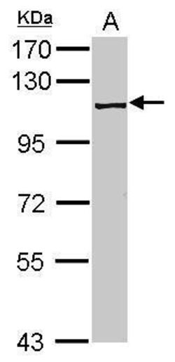 Invitrogen PRP6 Polyclonal Antibody 100 &mu;L; Unconjugated:Antibodies,