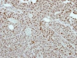 Invitrogen CREST Polyclonal Antibody 100 &mu;L | Buy Online | Invitrogen&trade; | Fisher Scientific