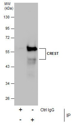 Invitrogen CREST Polyclonal Antibody 100 &mu;L | Buy Online | Invitrogen&trade; | Fisher Scientific