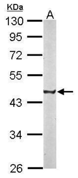 Invitrogen CREST Polyclonal Antibody 100 &mu;L | Buy Online | Invitrogen&trade; | Fisher Scientific