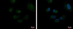 DECR2 Polyclonal Antibody:Antibodies, Polyclonal