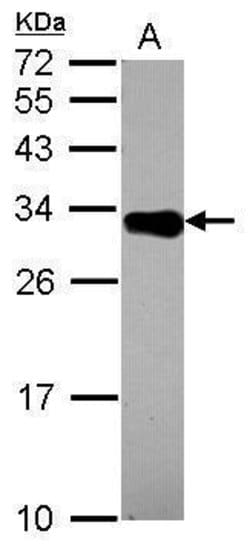 DECR2 Polyclonal Antibody:Antibodies, Polyclonal