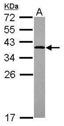 Invitrogen LDLRAP1 Polyclonal Antibody 100 μL; Unconjugated:Antibodies,