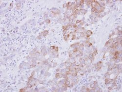 Invitrogen ARL5A Polyclonal Antibody 100 &mu;L | Buy Online | Invitrogen&trade; | Fisher Scientific