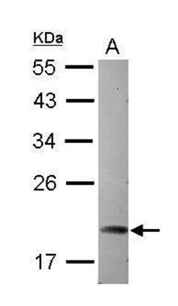 Invitrogen ARL5A Polyclonal Antibody 100 &mu;L | Buy Online | Invitrogen&trade; | Fisher Scientific