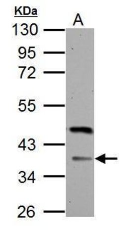 Invitrogen FBXO8 Polyclonal Antibody 100 &mu;L; Unconjugated:Antibodies,