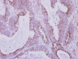 Invitrogen FBXO6 Polyclonal Antibody 100 μL; Unconjugated:Antibodies,