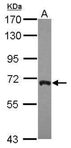 Invitrogen ARFGAP3 Polyclonal Antibody 100 &mu;L; Unconjugated:Antibodies,