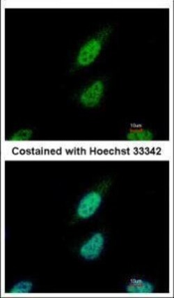 Invitrogen NARF Polyclonal Antibody 100 &mu;L | Buy Online | Invitrogen&trade; | Fisher Scientific
