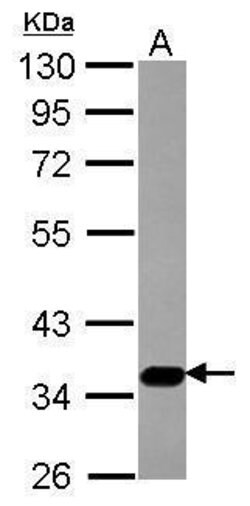 Invitrogen SLC17A5 Polyclonal Antibody 100 &mu;L | Buy Online | Invitrogen&trade; | Fisher Scientific