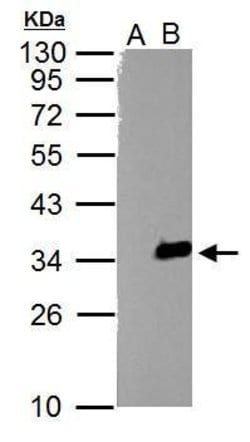Invitrogen TZFP Polyclonal Antibody 100 &mu;L; Unconjugated:Antibodies,