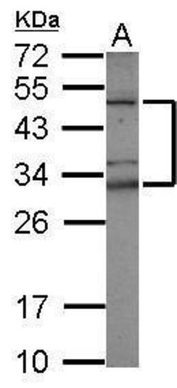 Invitrogen TZFP Polyclonal Antibody 100 &mu;L; Unconjugated:Antibodies,