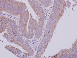 Invitrogen MTBP Polyclonal Antibody 100 &mu;L; Unconjugated:Antibodies,