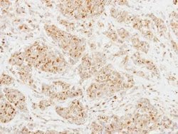 Invitrogen CLUL1 Polyclonal Antibody 100 &mu;L; Unconjugated:Antibodies,