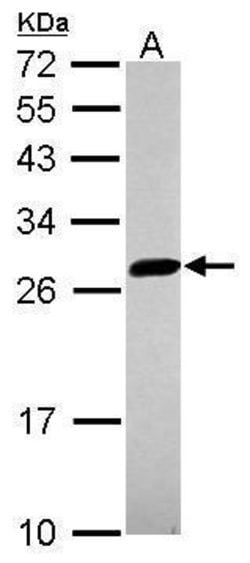 Invitrogen UBE2S Polyclonal Antibody 100 &mu;L | Buy Online | Invitrogen&trade; | Fisher Scientific