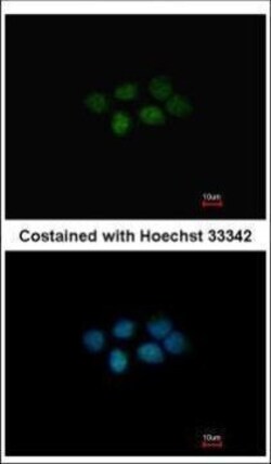 Invitrogen MAT2B Polyclonal Antibody 100 &mu;L; Unconjugated:Antibodies,