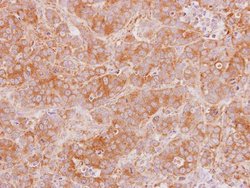 Invitrogen KappaB ras2 Polyclonal Antibody 100 μL; Unconjugated:Antibodies,