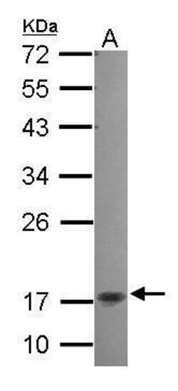 Invitrogen KappaB ras2 Polyclonal Antibody 100 μL; Unconjugated:Antibodies,