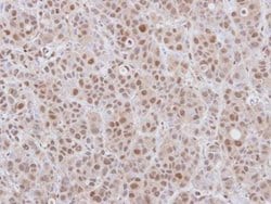 Invitrogen DCPS Polyclonal Antibody 100 &mu;L; Unconjugated:Antibodies,