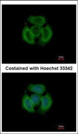 Invitrogen TMOD3 Polyclonal Antibody 100 &mu;L | Buy Online | Invitrogen&trade; | Fisher Scientific