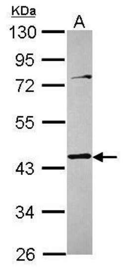 Invitrogen TMOD3 Polyclonal Antibody 100 &mu;L | Buy Online | Invitrogen&trade; | Fisher Scientific