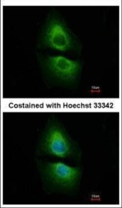 Invitrogen PSAT1 Polyclonal Antibody 100 μL; Unconjugated:Antibodies,