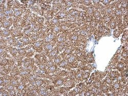 Invitrogen PSAT1 Polyclonal Antibody 100 μL; Unconjugated:Antibodies,